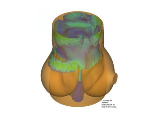 Incompressible CFD solver